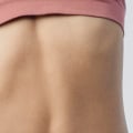Can coolsculpting cause permanent damage?