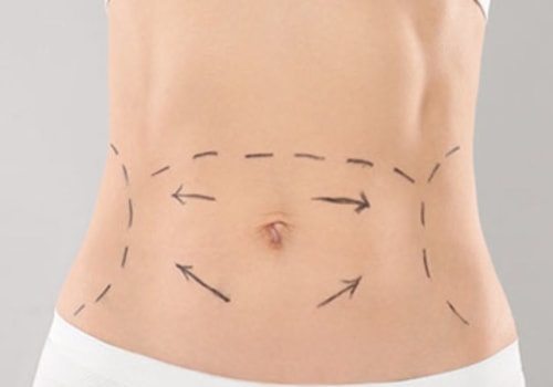 What are the negative effects of coolsculpting?